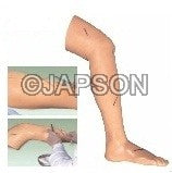 Suture Leg Advanced, Surgical Suture Leg Advanced, Surgical